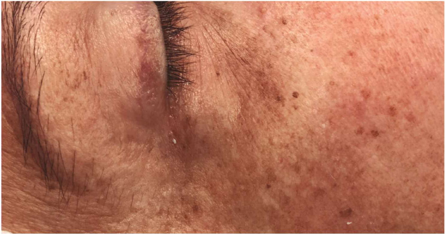 beautylounge-image-eyecon-3